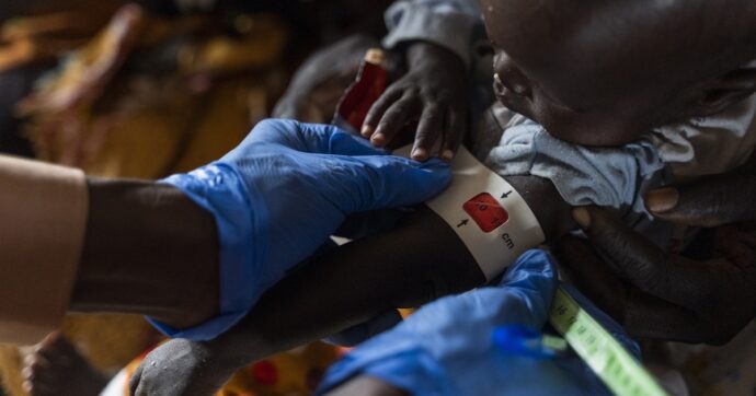 UNHCR, WHO warn of deteriorating health conditions as 1200 children die of suspected measles, malnutrition in Sudan